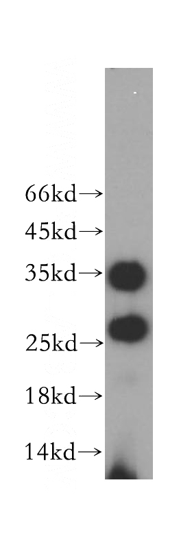 Raji cells were subjected to SDS PAGE followed by western blot with Catalog No:114280(PRSS2 antibody) at dilution of 1:400