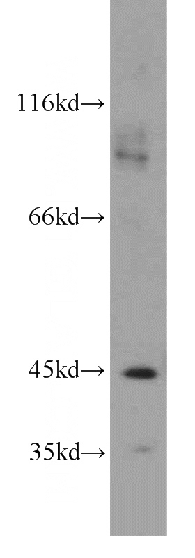 human brain tissue were subjected to SDS PAGE followed by western blot with Catalog No:108366(BBOX1 antibody) at dilution of 1:800
