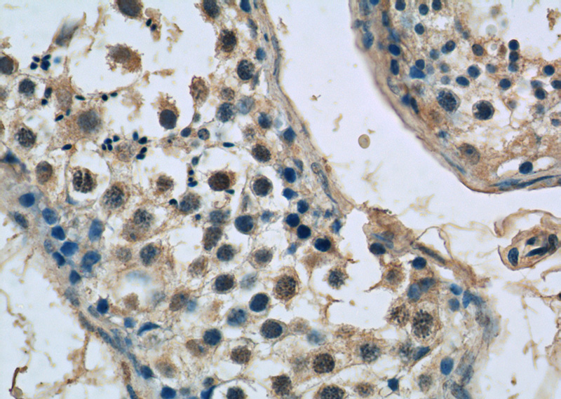 Immunohistochemistry of paraffin-embedded human testis tissue slide using Catalog No:115554(SPATA6 Antibody) at dilution of 1:50 (under 40x lens)
