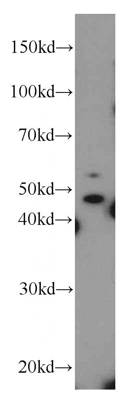 SGC-7901 cells were subjected to SDS PAGE followed by western blot with Catalog No:113262(NOB1 antibody) at dilution of 1:300