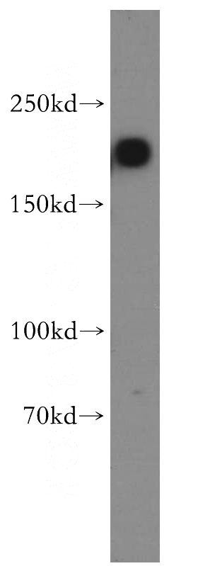 HeLa cells were subjected to SDS PAGE followed by western blot with Catalog No:108178(ARHGAP5 antibody) at dilution of 1:800