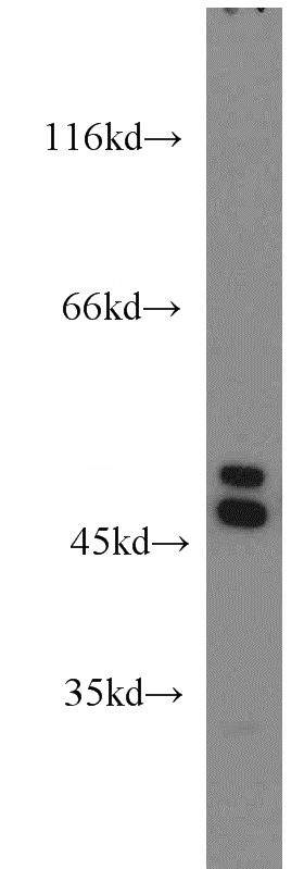 HeLa cells were subjected to SDS PAGE followed by western blot with Catalog No:111506(HNRNPF antibody) at dilution of 1:1000