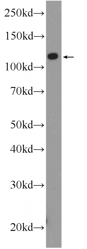 HeLa cells were subjected to SDS PAGE followed by western blot with Catalog No:108705(C21orf45 Antibody) at dilution of 1:300