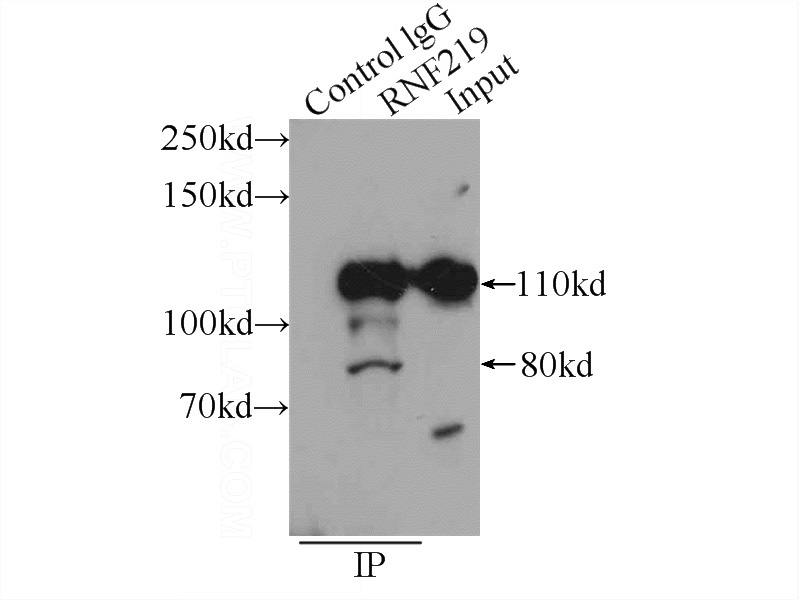 IP Result of anti-RNF219 (IP:Catalog No:114754, 4ug; Detection:Catalog No:114754 1:300) with A431 cells lysate 1200ug.