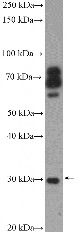 mouse liver tissue were subjected to SDS PAGE followed by western blot with Catalog No:109448(COMT Antibody) at dilution of 1:600