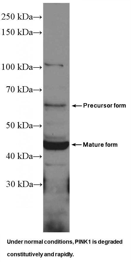 HeLa cells were subjected to SDS PAGE followed by western blot with Catalog No:113910(PINK1 Antibody) at dilution of 1:600