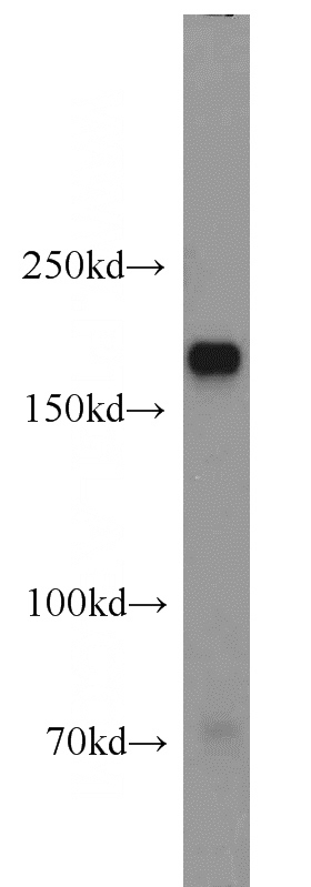HepG2 cells were subjected to SDS PAGE followed by western blot with Catalog No:111857(ITGA1 antibody) at dilution of 1:1000