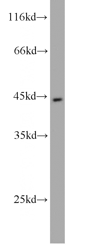 SGC-7901 cells were subjected to SDS PAGE followed by western blot with Catalog No:113708(PGA5 antibody) at dilution of 1:1000
