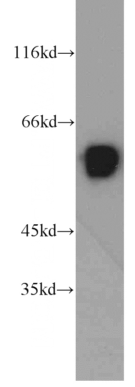 Jurkat cells were subjected to SDS PAGE followed by western blot with Catalog No:116627(UPF3B antibody) at dilution of 1:2000