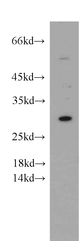 mouse brain tissue were subjected to SDS PAGE followed by western blot with Catalog No:110381(ESPN antibody) at dilution of 1:200
