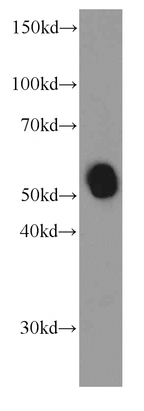 human saliva were subjected to SDS PAGE followed by western blot with Catalog No:107583(AMY2A antibody) at dilution of 1:2000