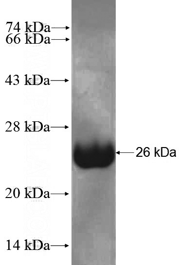 Recombinant Human NELL1 SDS-PAGE