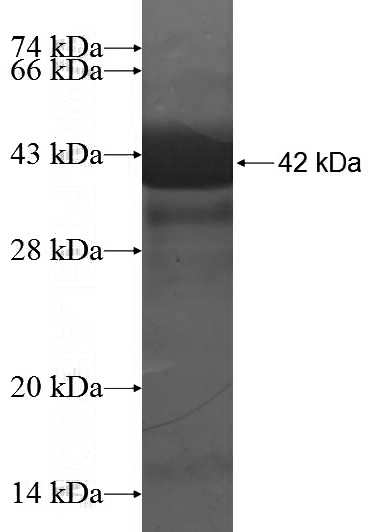 Recombinant Human RNMT SDS-PAGE