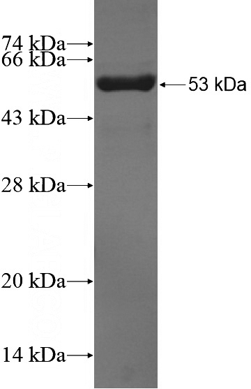Recombinant Human TRIM38 SDS-PAGE