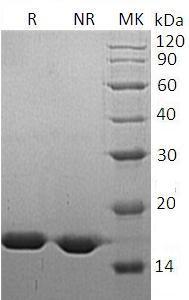 Human FABP5 (His tag) recombinant protein