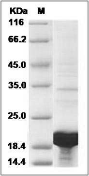 Human LSM1 Protein (His Tag) SDS-PAGE