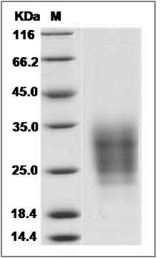 Human SCN2B Protein (His Tag) SDS-PAGE