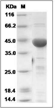 Human NDRG1 / CAP43 Protein (His Tag) SDS-PAGE