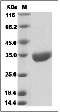 Mouse ANTXR2 / CMG2 Protein (His Tag) SDS-PAGE