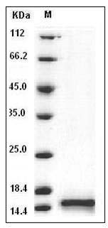 Human Cystatin B / CSTB Protein (His Tag) SDS-PAGE