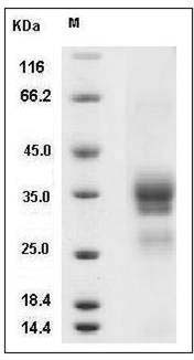 Human OLR1 / LOX1 Protein (His Tag) SDS-PAGE