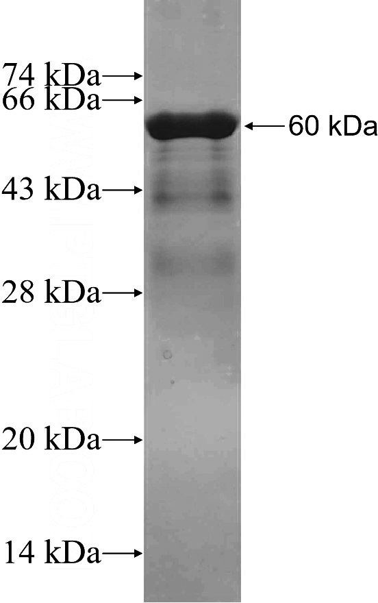 Recombinant Human CBX4 SDS-PAGE