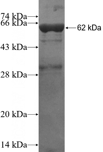 Recombinant Human SRPR SDS-PAGE