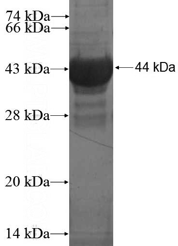 Recombinant Human MTRF1 SDS-PAGE