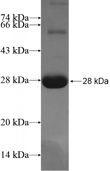 Recombinant Human SCAMP2 SDS-PAGE