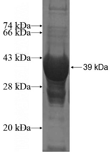 Recombinant Human FAM107A SDS-PAGE