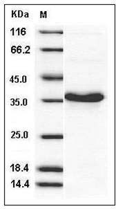 Human HABP1 / C1QBP / GC1QBP Protein (His Tag) SDS-PAGE
