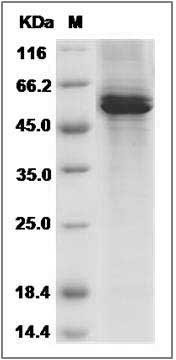 Human AMY2A / Alpha-amylase Protein(His Tag) SDS-PAGE