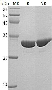 Human CA1 (His tag) recombinant protein