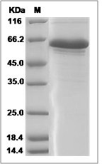 Human CNPY3 / PRAT4A / ERDA5 Protein (Fc Tag) SDS-PAGE