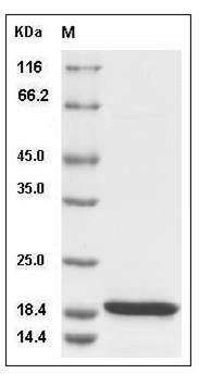 Human KIAA0101 / p15 / PAF Protein (His Tag) SDS-PAGE