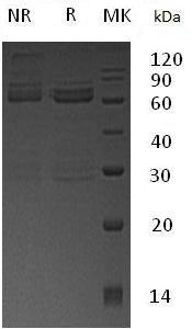 Human CAMK1D/CAMKID (GST tag) recombinant protein
