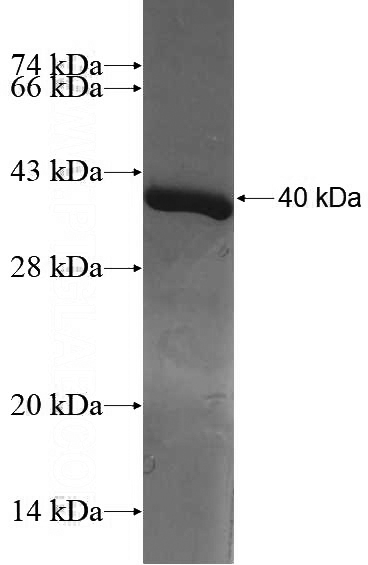 Recombinant Human BCL2L14 SDS-PAGE