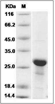 Human MID1IP1 Protein (His Tag) SDS-PAGE