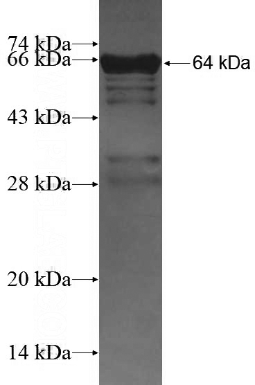 Recombinant Human DIAPH3 SDS-PAGE