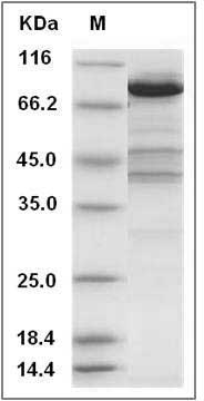 Human EZR / VIL2 / Ezrin Protein (His Tag) SDS-PAGE