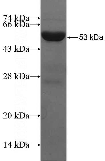 Recombinant Human EIF4A3 SDS-PAGE