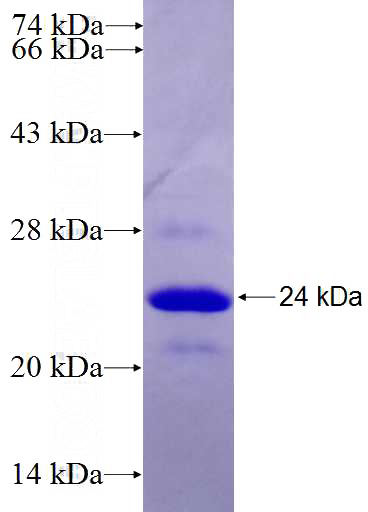 Recombinant Human TBRG1 SDS-PAGE