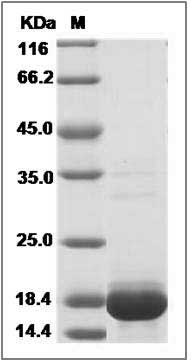 Human THEM2 / ACOT13 Protein (His Tag) SDS-PAGE