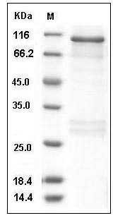 Human RSK3 / RPS6KA2 Protein (GST Tag) SDS-PAGE