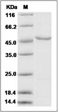 Human CARKL / SHPK Protein SDS-PAGE