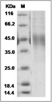 Rat OLR1 / LOX1 Protein (His Tag) SDS-PAGE