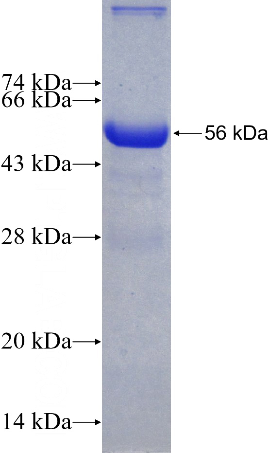 Recombinant Human NNMT SDS-PAGE