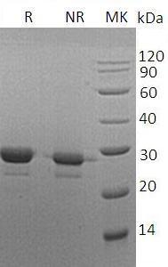 Human MOB1A/C2orf6/MOB4B/MOBK1B/MOBKL1B (His tag) recombinant protein