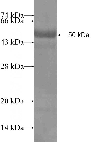 Recombinant Human BCMO1 SDS-PAGE