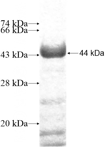 Recombinant Human RAB11FIP1 SDS-PAGE